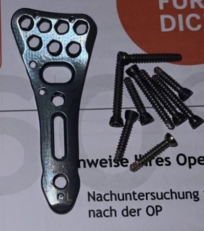 Titanplatte/-schrauben zu Schmuck verarbeiten?